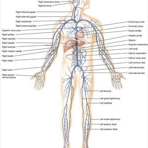 Varicose Vein Thrombosis 