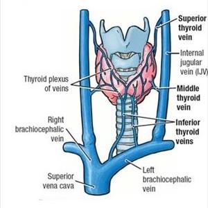 Varicose Man 