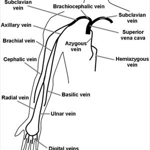  The Treatment Of Varicose Veins