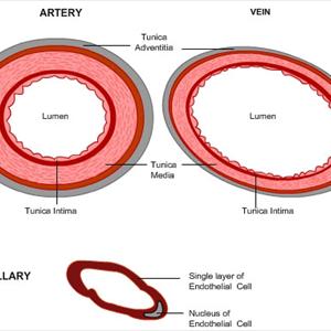  What Are Varicose Veins