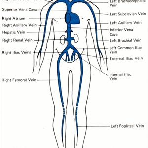 Varicose Seal Testicles 