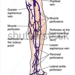  Different Types Of Varicose Veins You Should Know About